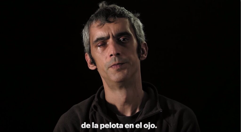 Irídia presenta el escrito de acusación contra cuatro agentes del Cuerpo Nacional de Policía por las lesiones graves causadas a Roger Español el 1-O